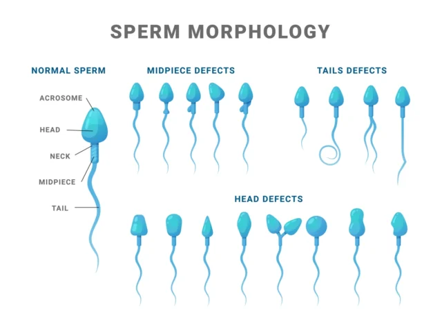 Understanding Sperm Count: What Every Man Should Know